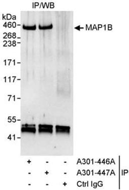 Detection of human MAP1B by western blot of immunoprecipitates.