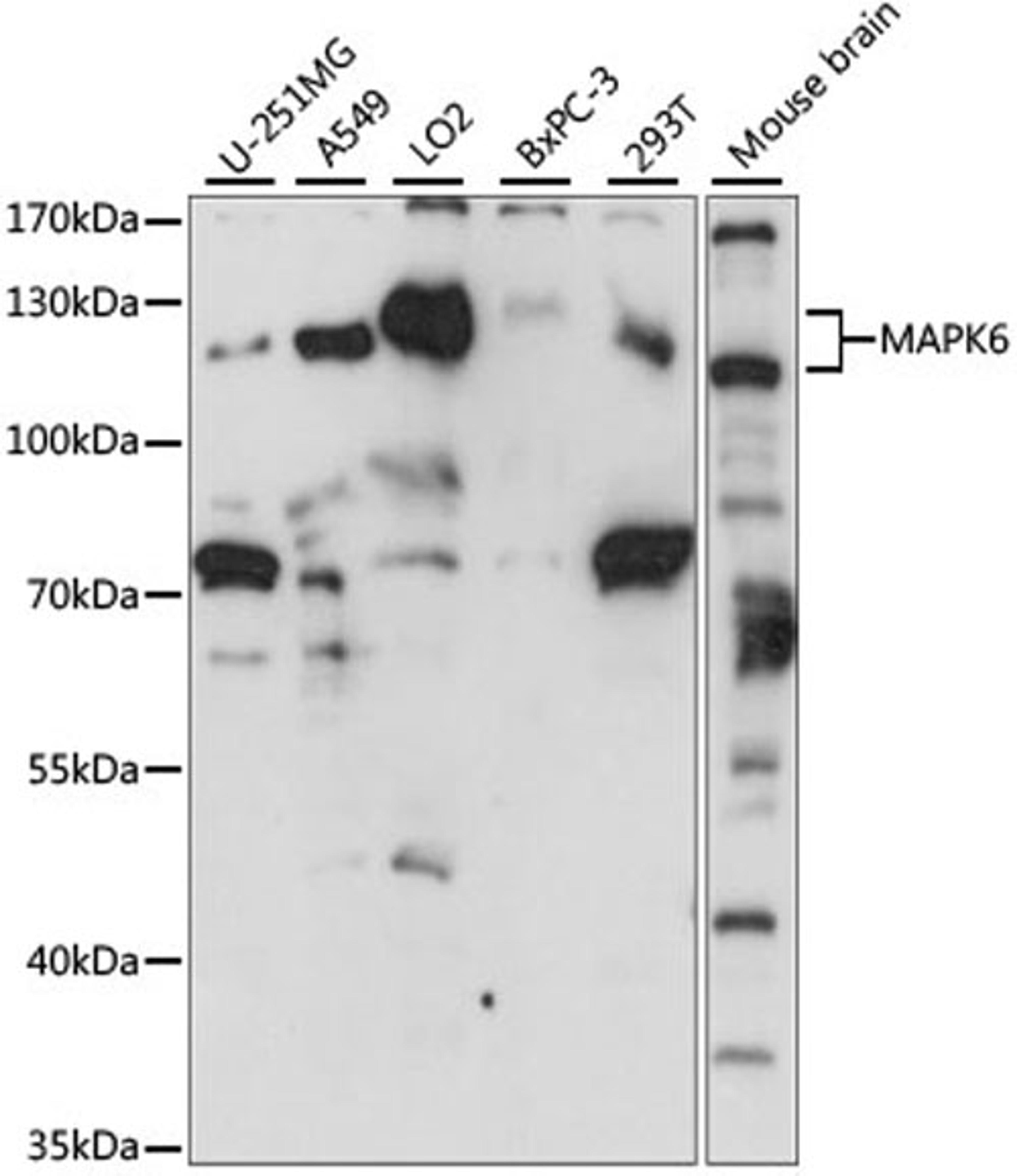 Western blot - MAPK6 antibody (A15304)