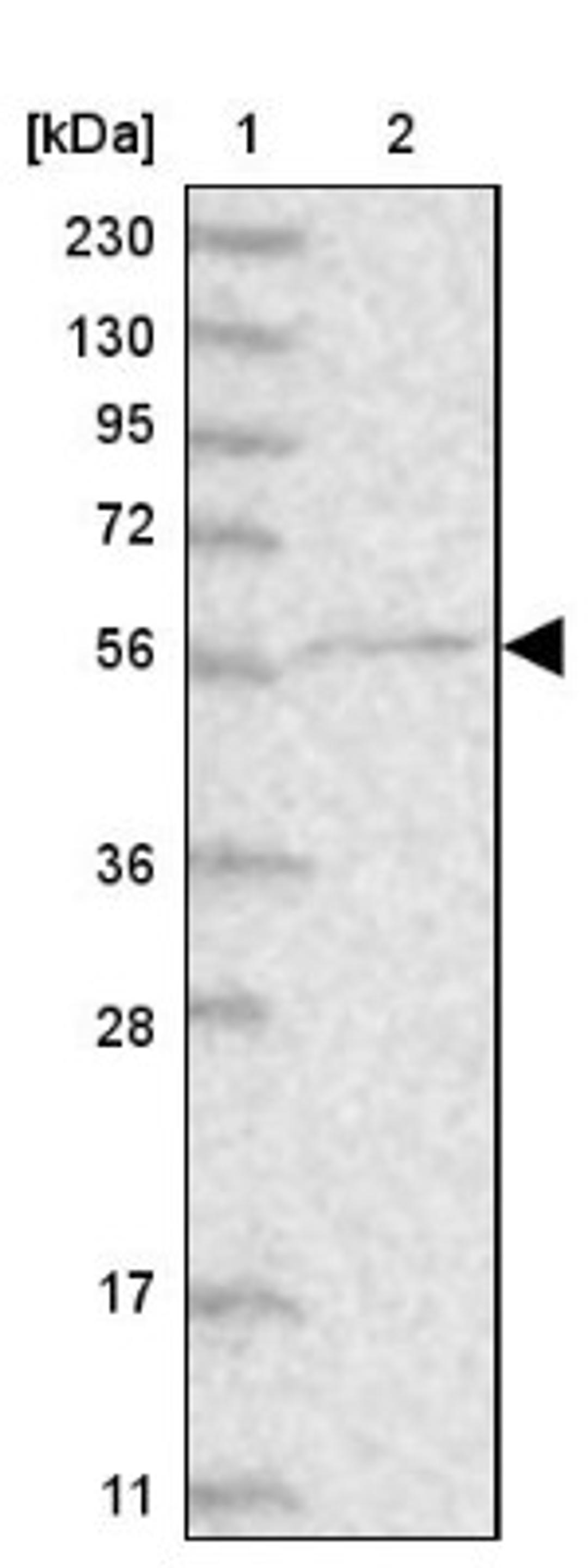 Western Blot: CDS1 Antibody [NBP1-85894] - Lane 1: Marker [kDa] 230, 130, 95, 72, 56, 36, 28, 17, 11<br/>Lane 2: Human cell line RT-4