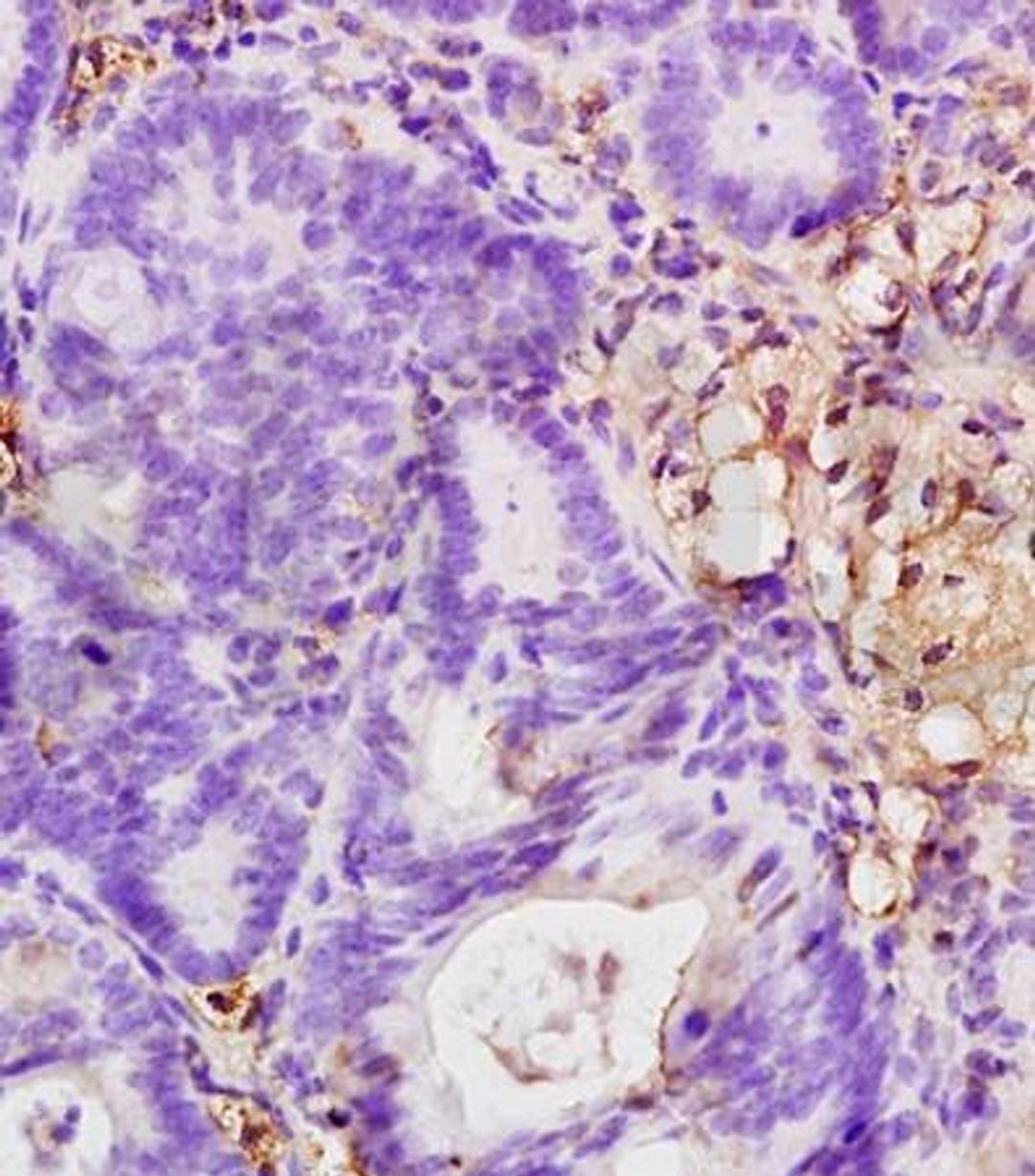 Immunohistochemical analysis of formalin fixed and paraffin embedded rat colitis tissue using CD18 antibody