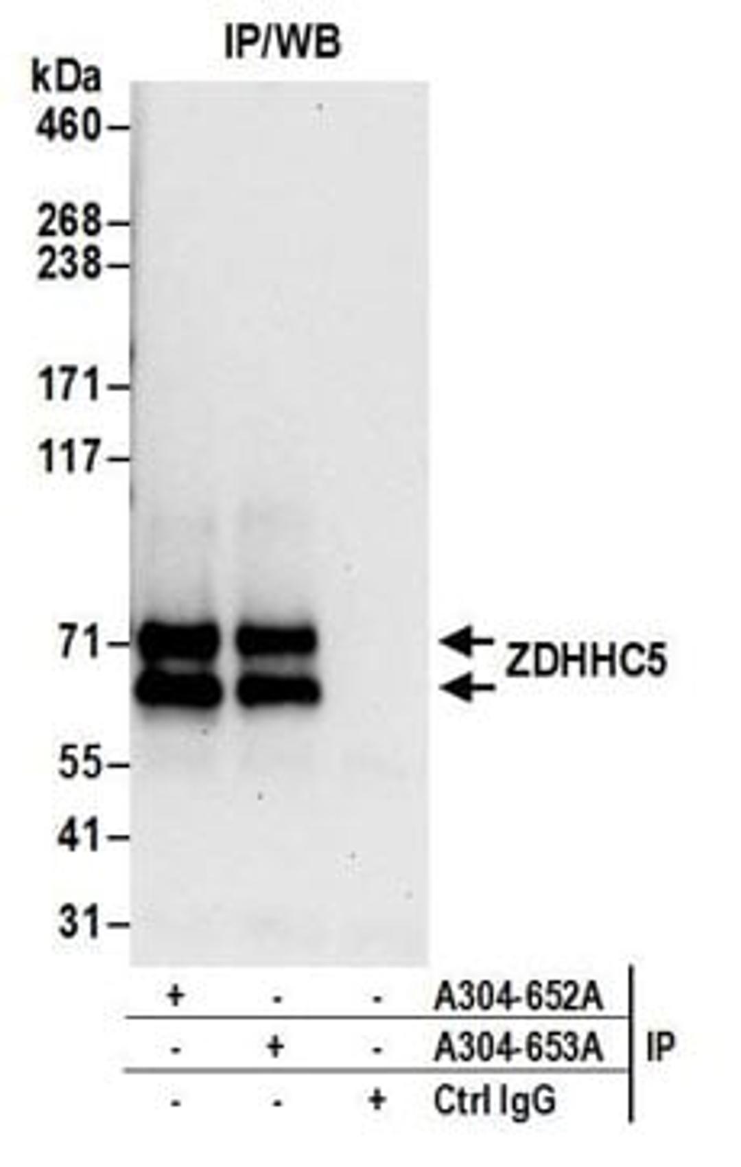 Detection of human ZDHHC5 by western blot of immunoprecipitates.