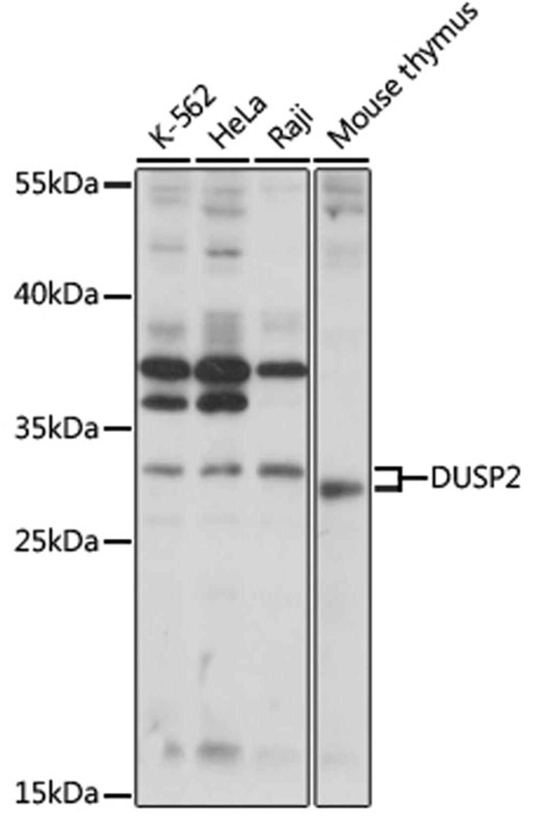 Western blot - DUSP2 antibody (A16366)