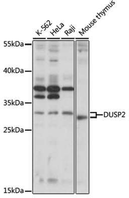 Western blot - DUSP2 antibody (A16366)