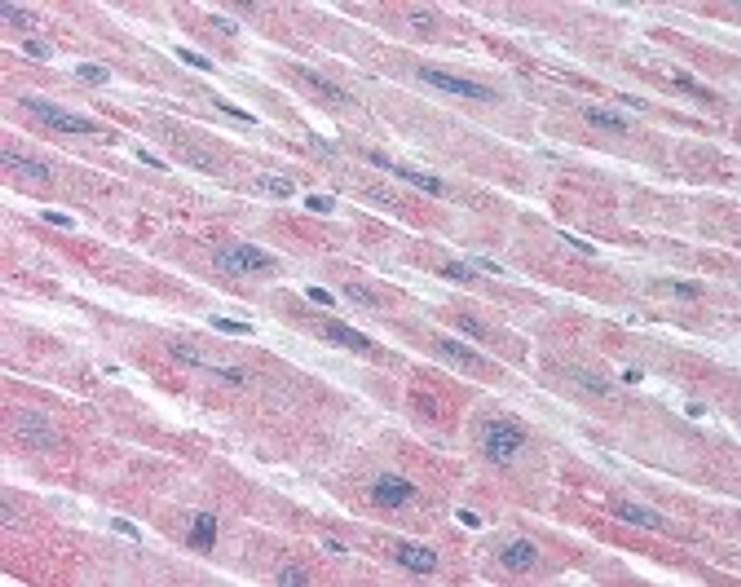 Immunohistochemistry staining of PLA2G5 in heart tissue using PLA2G5 monoclonal Antibody.