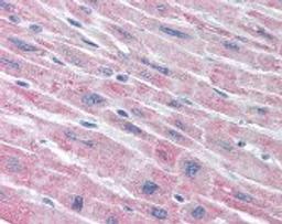 Immunohistochemistry staining of PLA2G5 in heart tissue using PLA2G5 monoclonal Antibody.