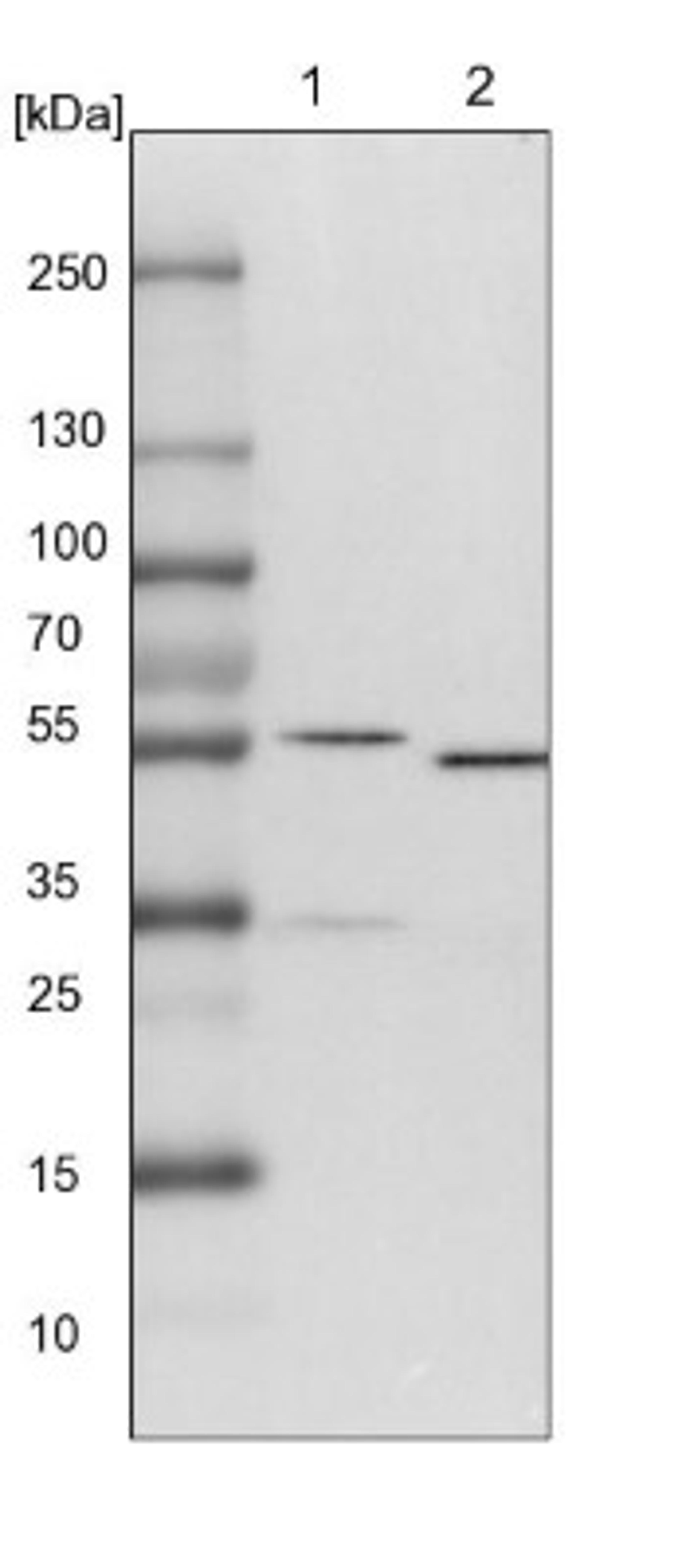 Western Blot: KCTD20 Antibody [NBP1-86738] - Lane 1: NIH-3T3 cell lysate (Mouse embryonic fibroblast cells)<br/>Lane 2: NBT-II cell lysate (Rat Wistar bladder tumour cells)