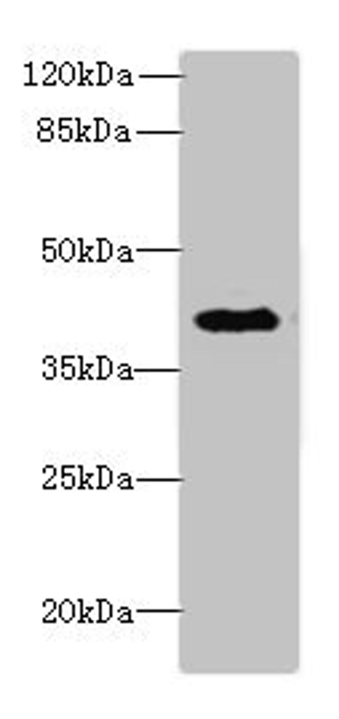 Western blot. All lanes: DCN antibody at 6µg/ml + Jurkat whole cell lysate. Secondary. Goat polyclonal to rabbit IgG at 1/10000 dilution. Predicted band size: 40 kDa. Observed band size: 40 kDa
