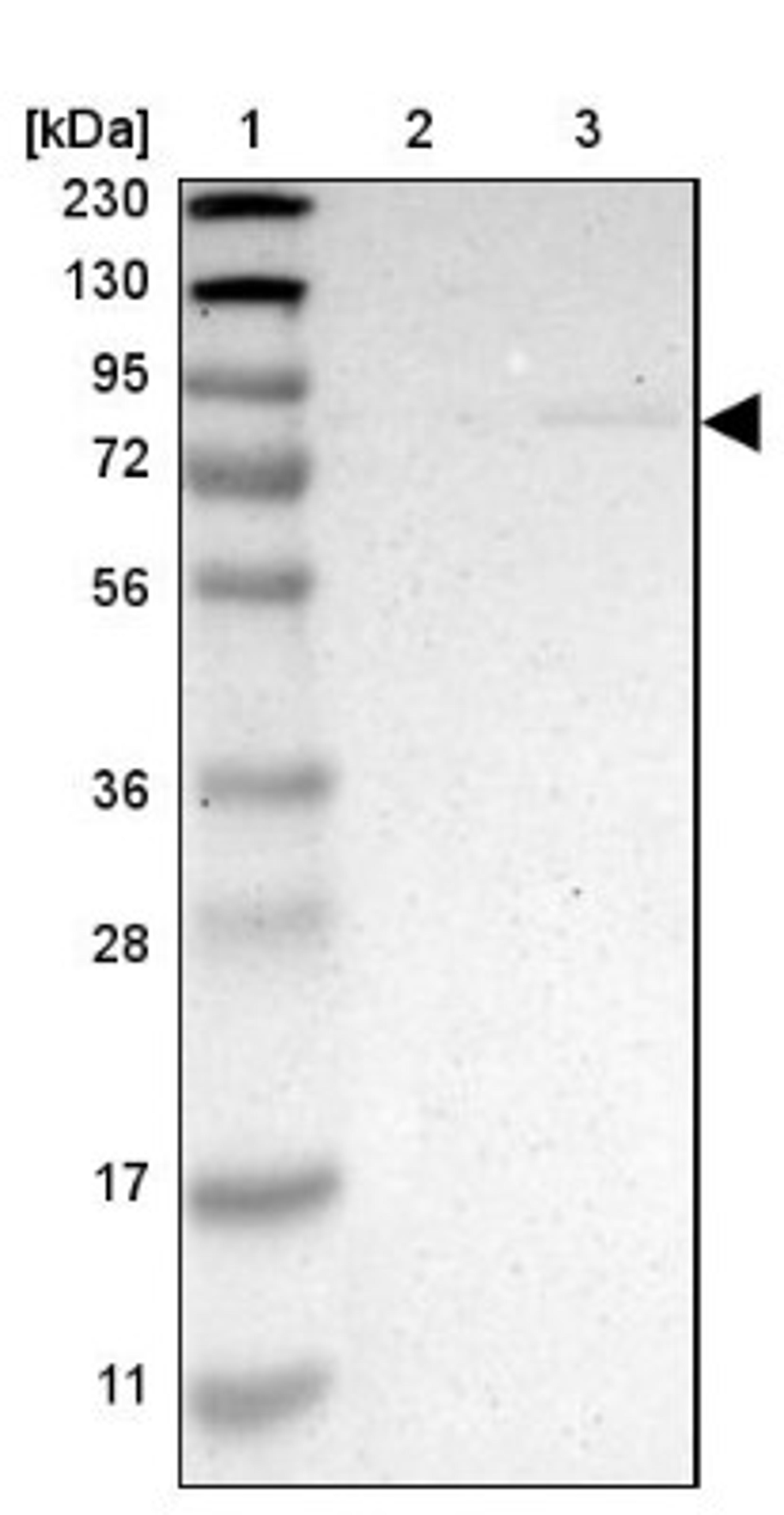 Western Blot: ZMAT1 Antibody [NBP1-81375] - Lane 1: Marker [kDa] 230, 130, 95, 72, 56, 36, 28, 17, 11<br/>Lane 2: Human cell line RT-4<br/>Lane 3: Human cell line U-251MG sp