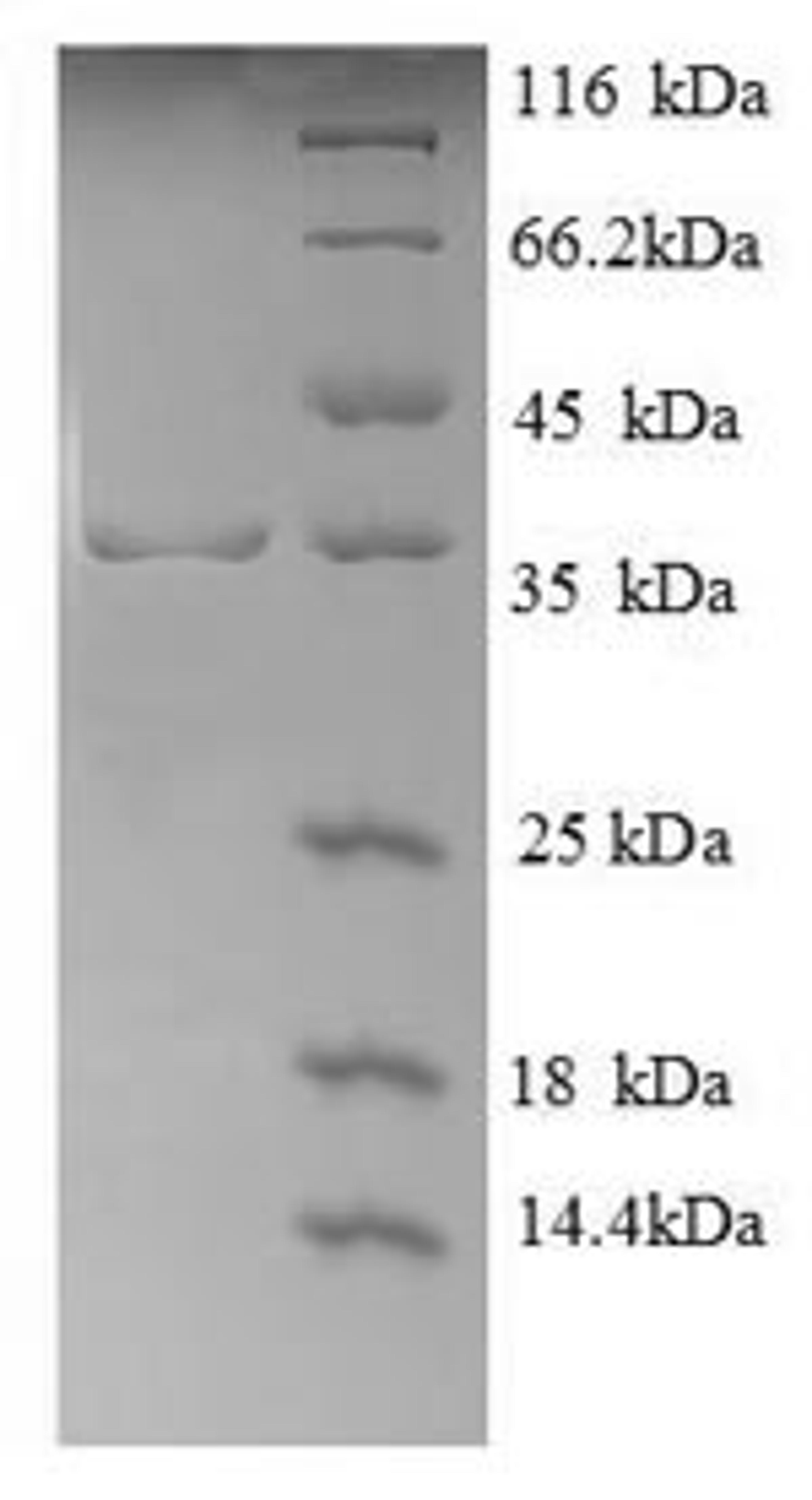 (Tris-Glycine gel) Discontinuous SDS-PAGE (reduced) with 5% enrichment gel and 15% separation gel.