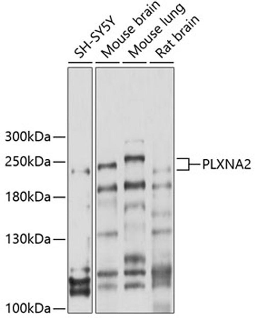 Western blot - PLXNA2 antibody (A10087)