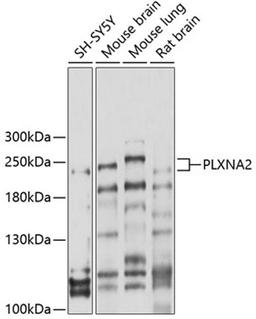 Western blot - PLXNA2 antibody (A10087)