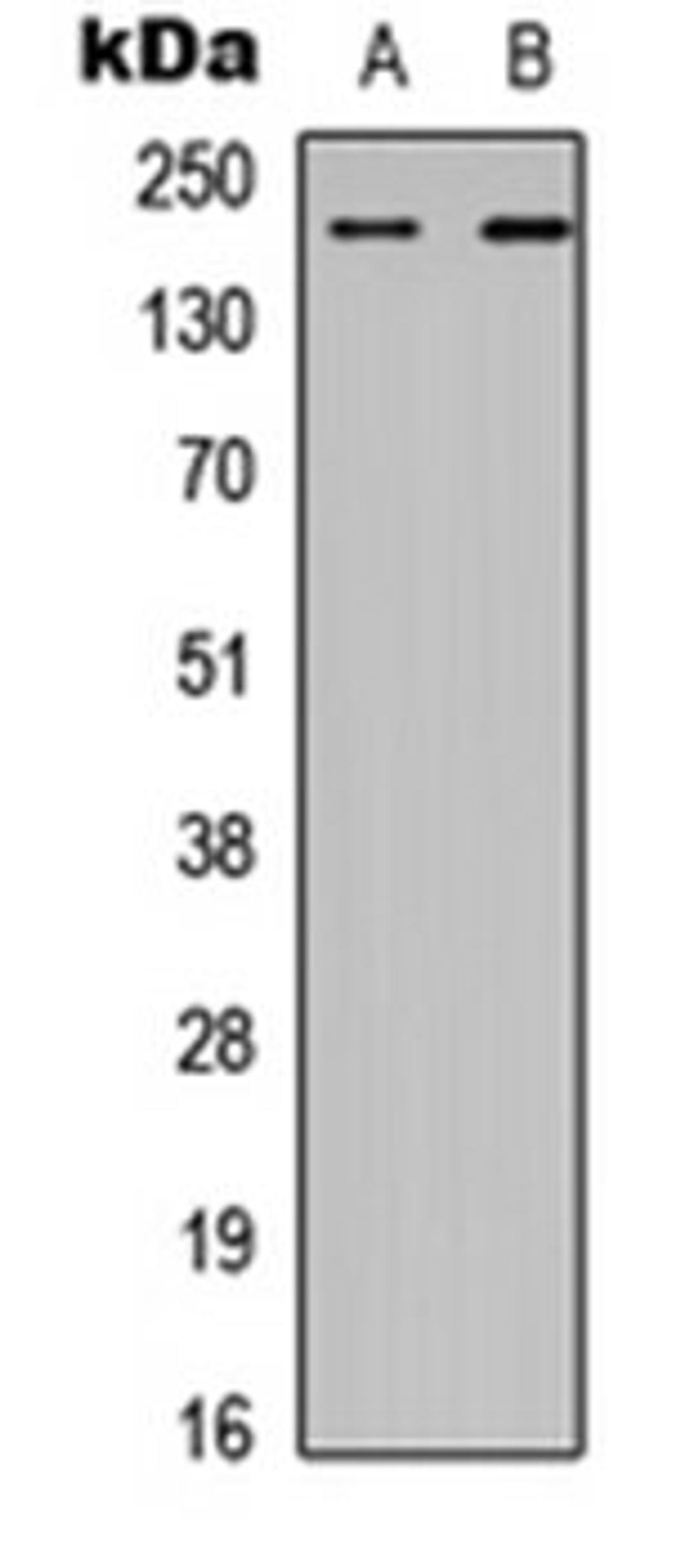 Western blot analysis of HEK293T (Lane 1), A549 (Lane 2) whole cell lysates using CHD2 antibody