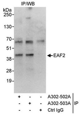 Detection of human EAF2 by western blot of immunoprecipitates.