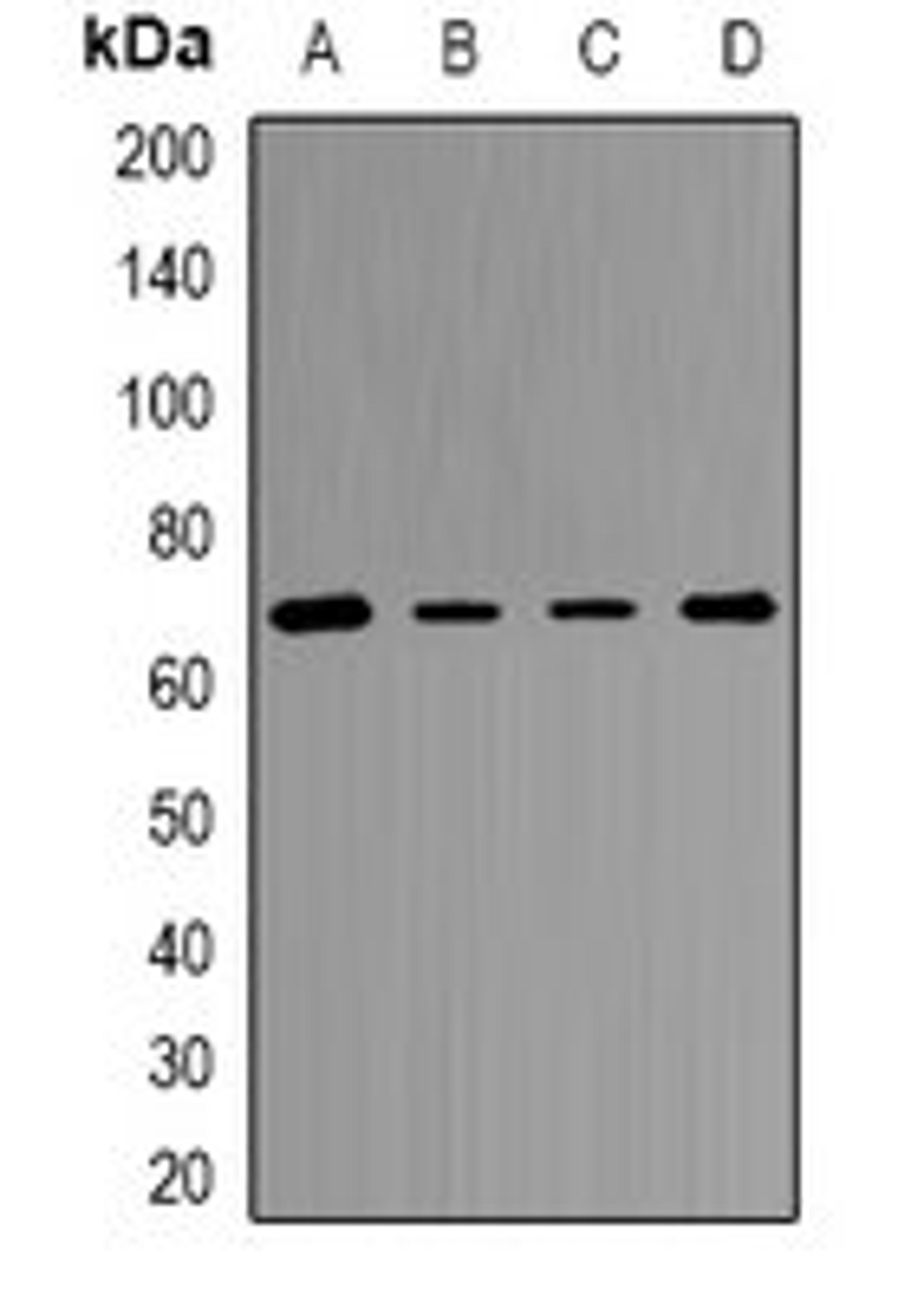 Western blot analysis of Jurkat (Lane1), MCF7 (Lane2), mouse liver (Lane3), rat kidney (Lane4) whole cell lysates using TKT antibody