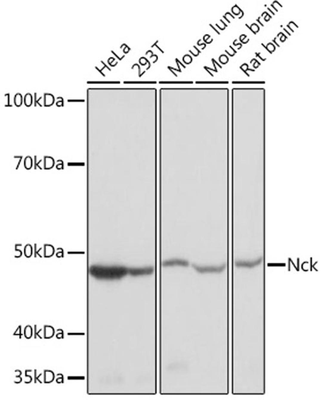 Western blot - Nck Rabbit mAb (A9129)