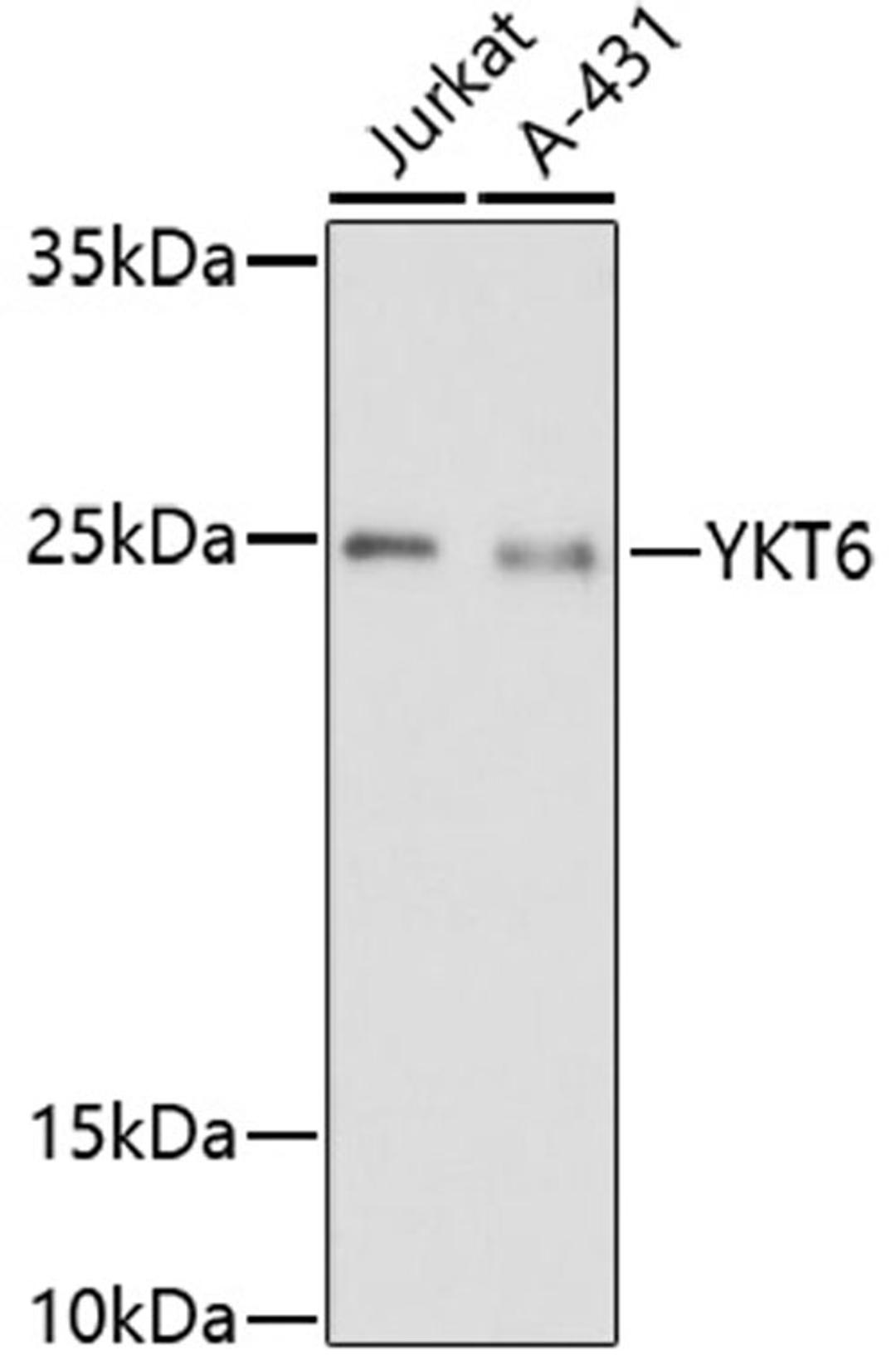 Western blot - YKT6 antibody (A17084)