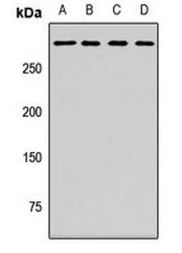 Western blot analysis of Hela (Lane1), Jurkat (Lane2), mouse brain (Lane3), rat brain (Lane4) whole cell lysates using MYO18A antibody