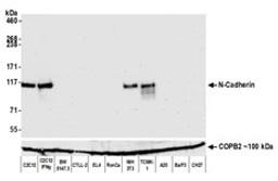 Detection of mouse N-Cadherin by western blot.