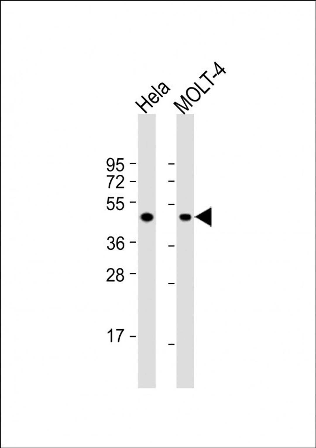 Western Blot at 1:1000 dilution Lane 1: Hela whole cell lysate Lane 2: MOLT-4 whole cell lysate Lysates/proteins at 20 ug per lane.