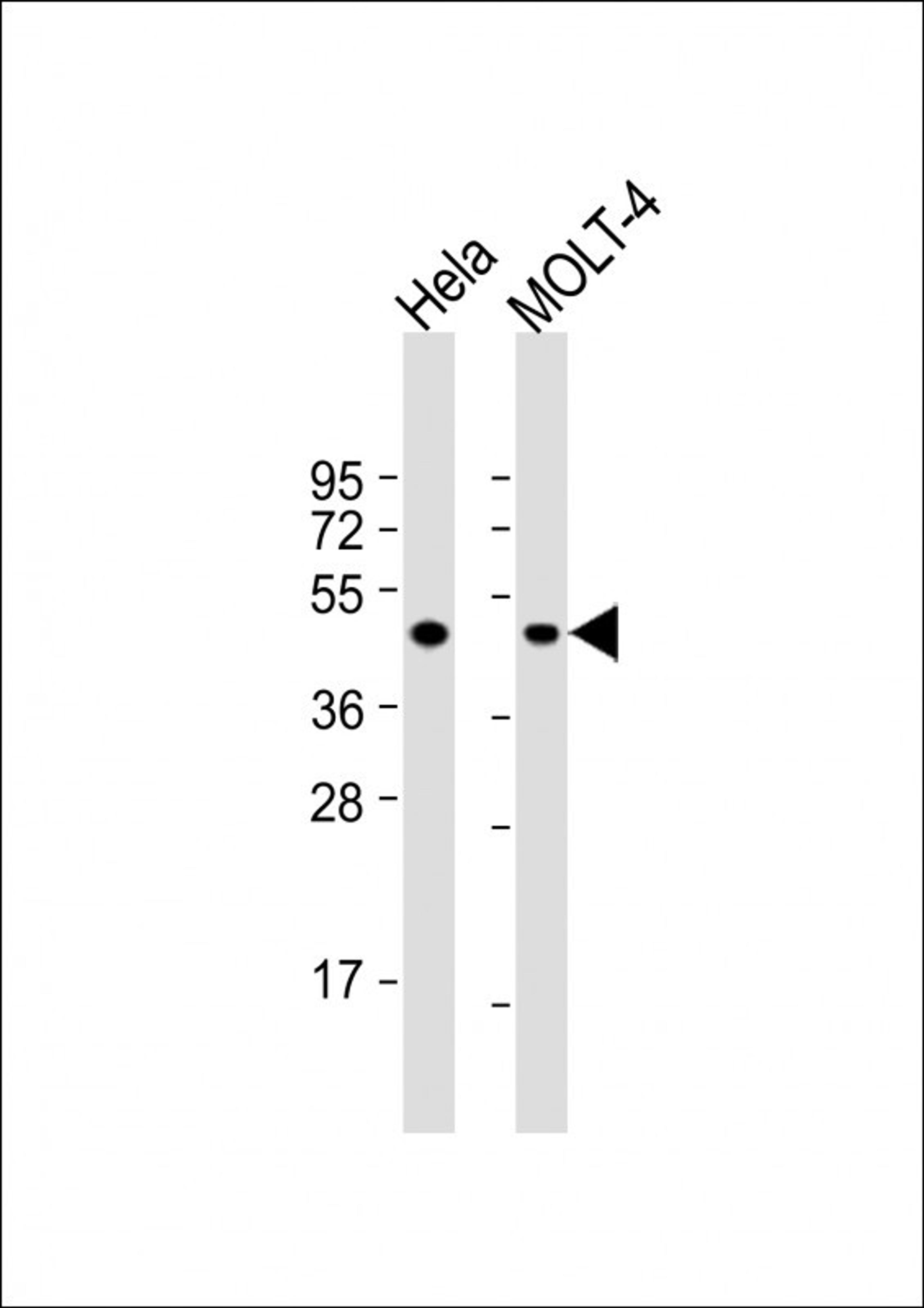 Western Blot at 1:1000 dilution Lane 1: Hela whole cell lysate Lane 2: MOLT-4 whole cell lysate Lysates/proteins at 20 ug per lane.