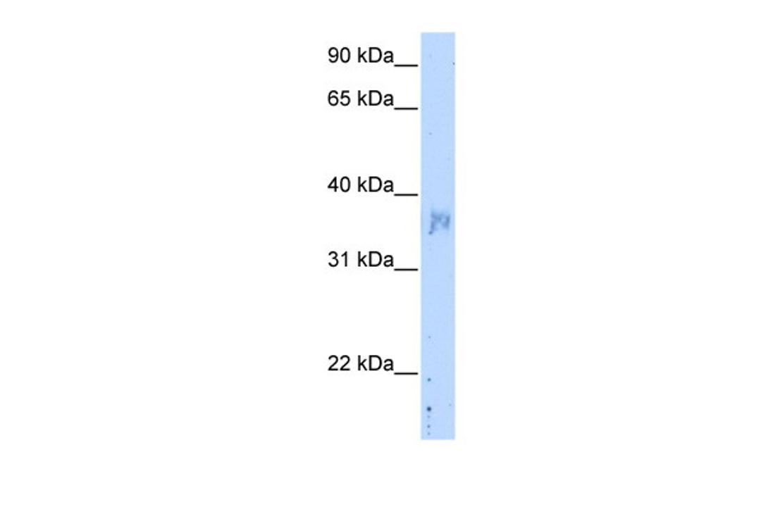 Antibody used in WB on Transfected 293T at 5.0 ug/ml.