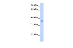 Antibody used in WB on Transfected 293T at 5.0 ug/ml.