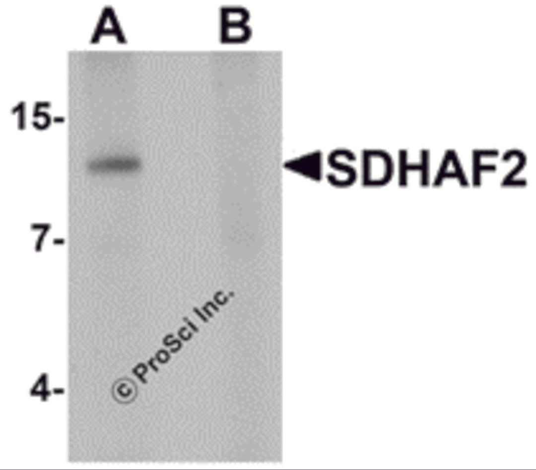 Western blot analysis of SDHAF2 in rat liver tissue lysate with SDHAF2 antibody at 1 μg/mL in (A) the absence and (B) the presence of blocking peptide.
