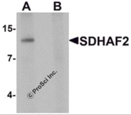 Western blot analysis of SDHAF2 in rat liver tissue lysate with SDHAF2 antibody at 1 μg/mL in (A) the absence and (B) the presence of blocking peptide.