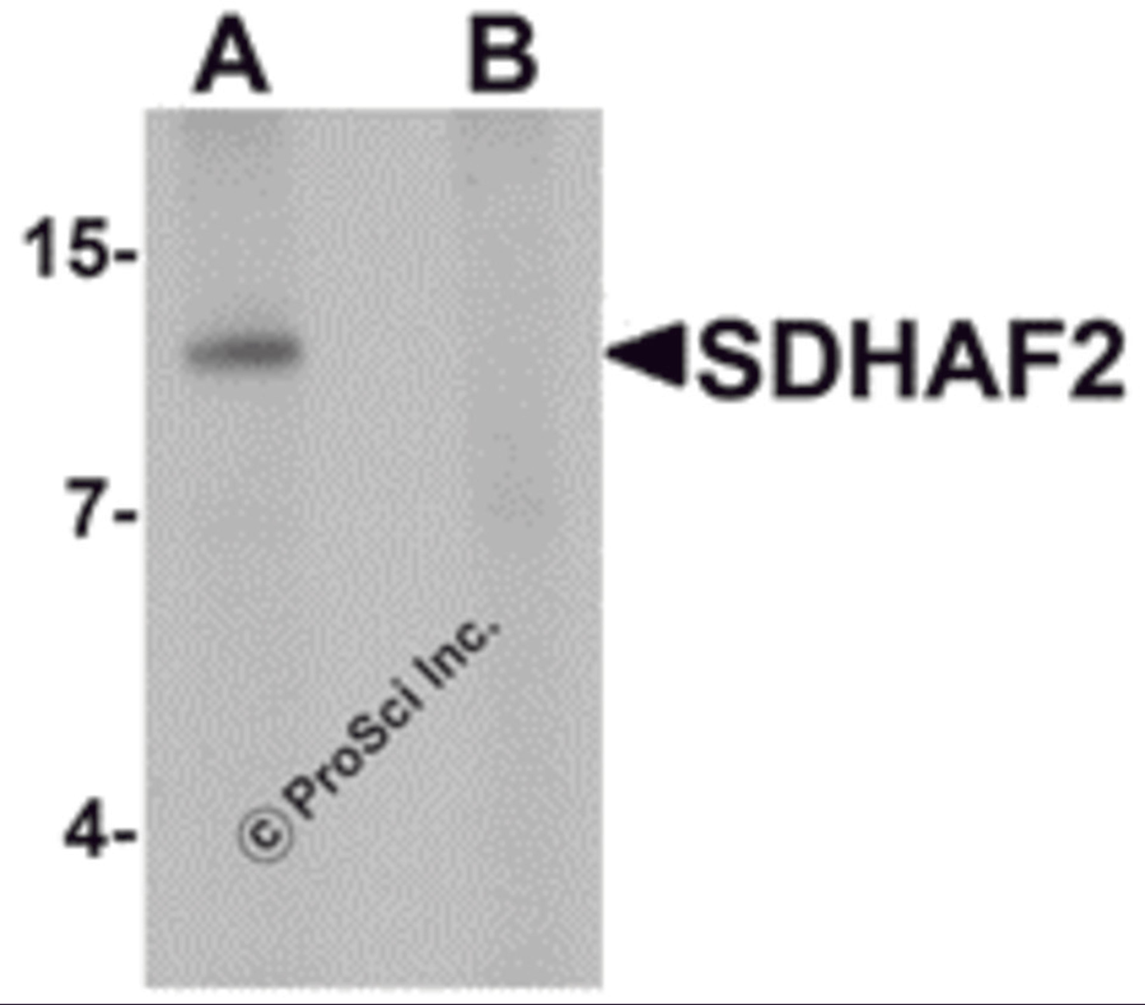 Western blot analysis of SDHAF2 in rat liver tissue lysate with SDHAF2 antibody at 1 μg/mL in (A) the absence and (B) the presence of blocking peptide.