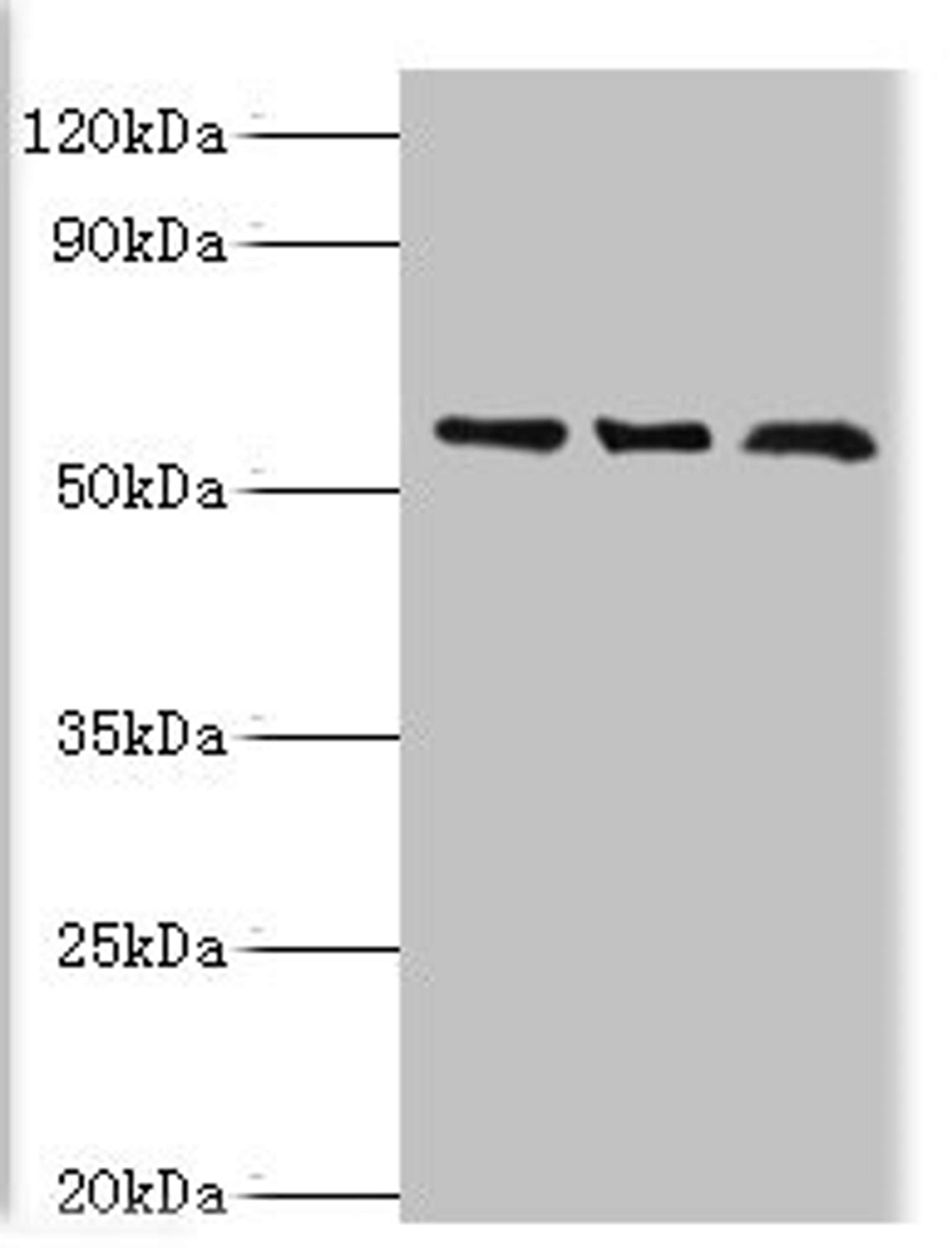 Western blot. All lanes: F-box-like/WD repeat-containing protein TBL1XR1 antibody at 10ug/ml. Lane 1: MCF-7 whole cell lysate. Lane 2: Mouse heart tissue. Lane 3: K562 whole cell lysate. Secondary. Goat polyclonal to rabbit IgG at 1/10000 dilution. Predicted band size: 56 kDa. Observed band size: 56 kDa.