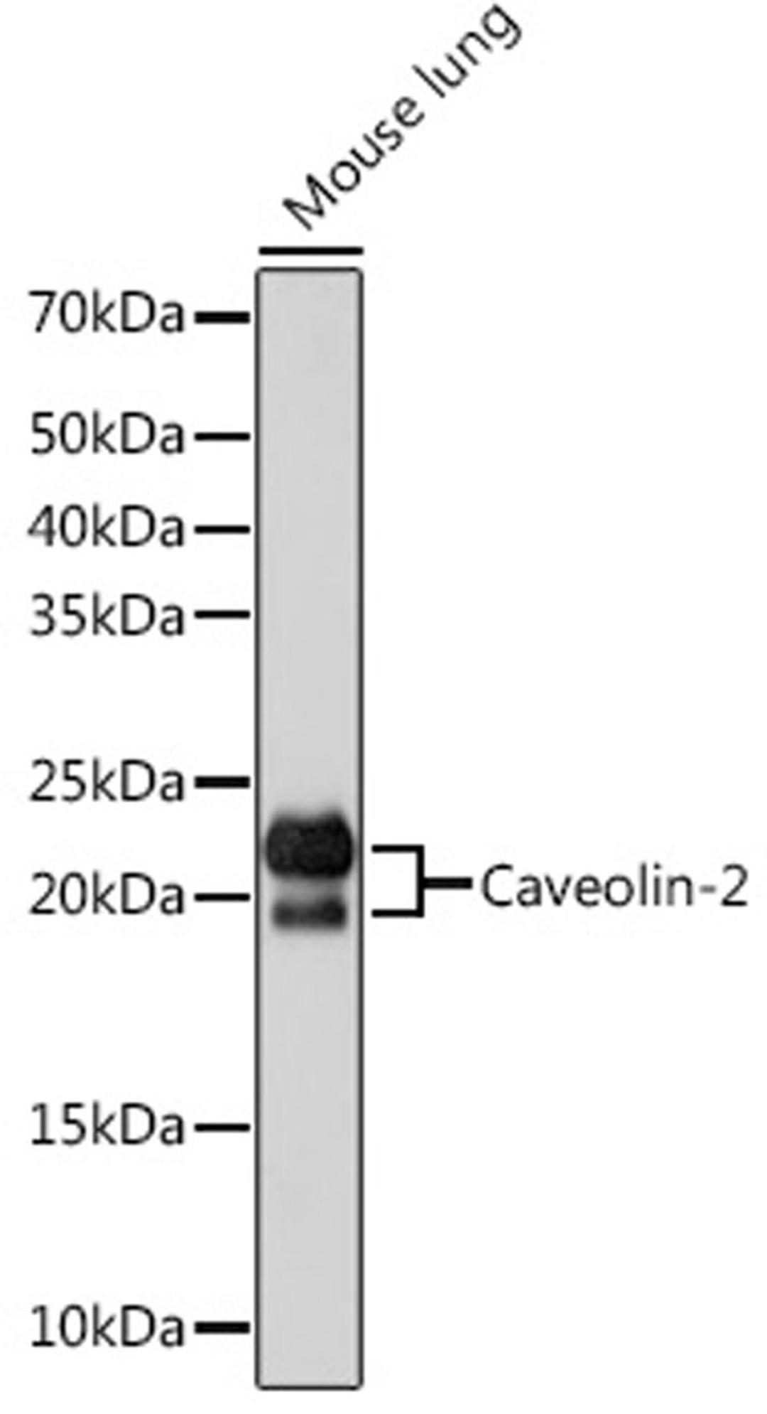 Western blot - Caveolin-2  Rabbit mAb (A4890)