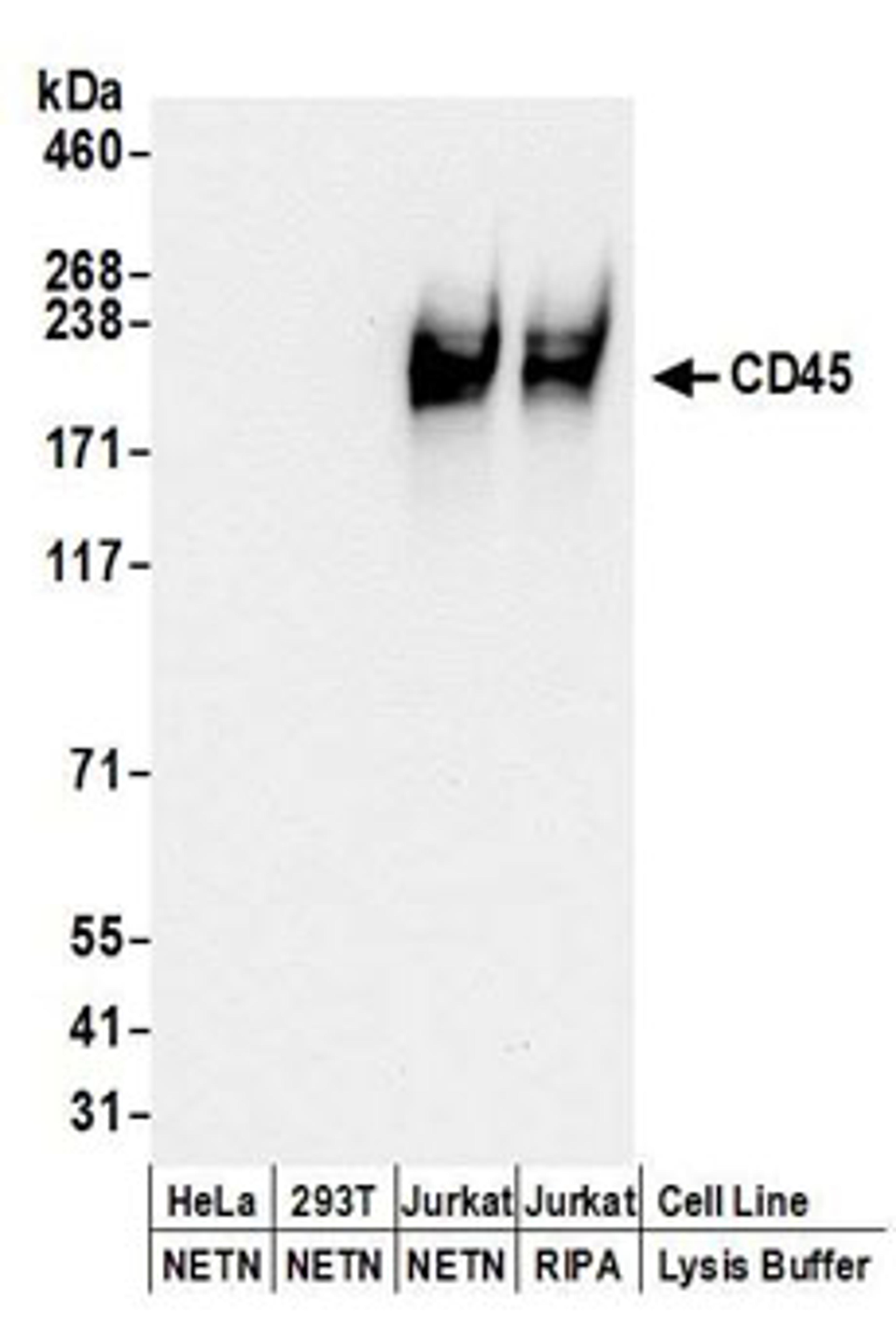 Detection of human CD45 by western blot.