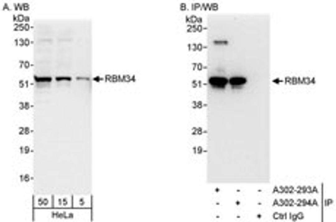 Detection of human RBM34 by western blot and immunoprecipitation.