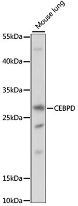 Western blot - CEBPD antibody (A15261)