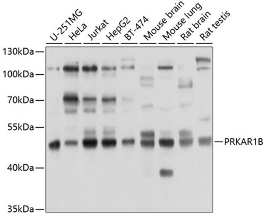 Western blot - PRKAR1B antibody (A10125)