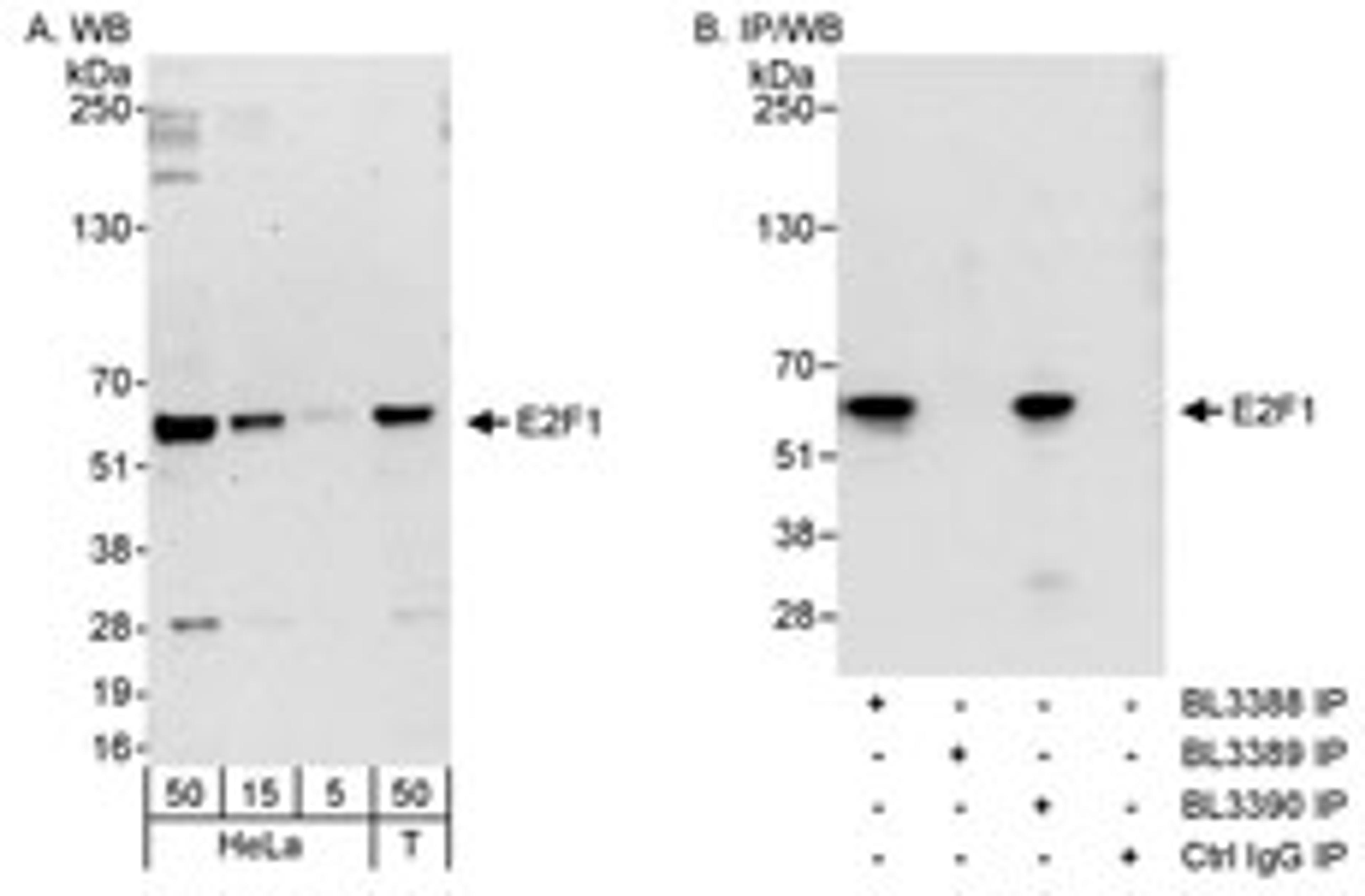 Detection of human E2F1 by western blot and immunoprecipitation.