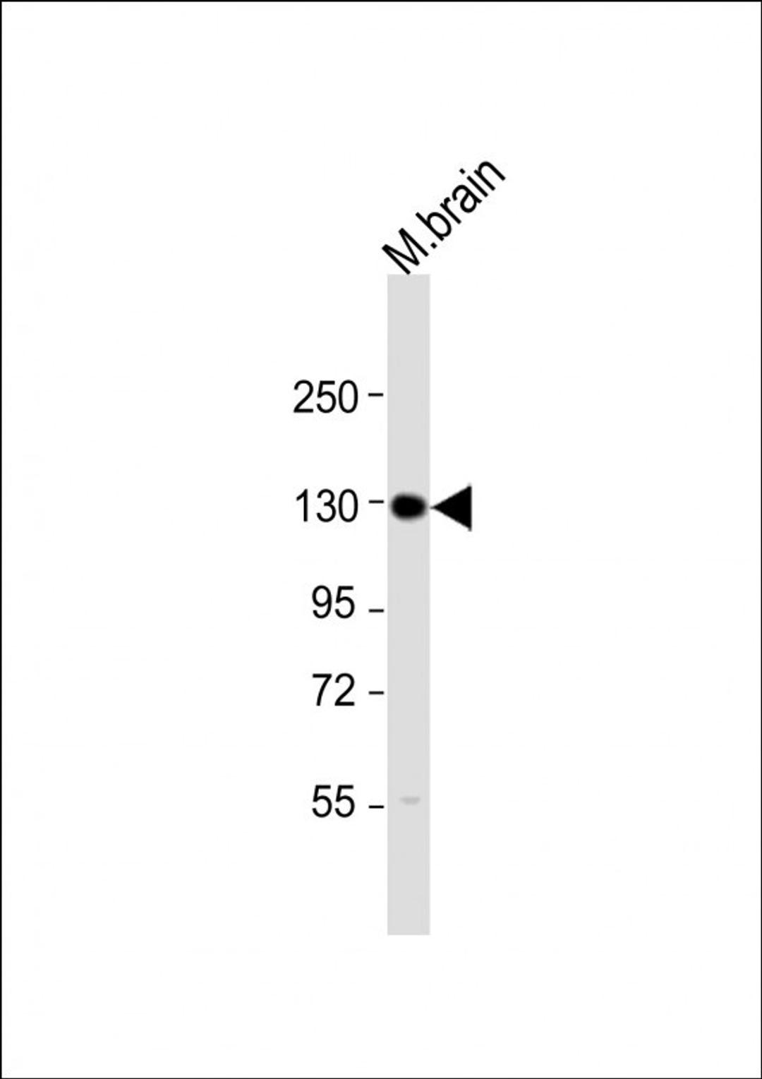 Western Blot at 1:2000 dilution + mouse brain lysate Lysates/proteins at 20 ug per lane.