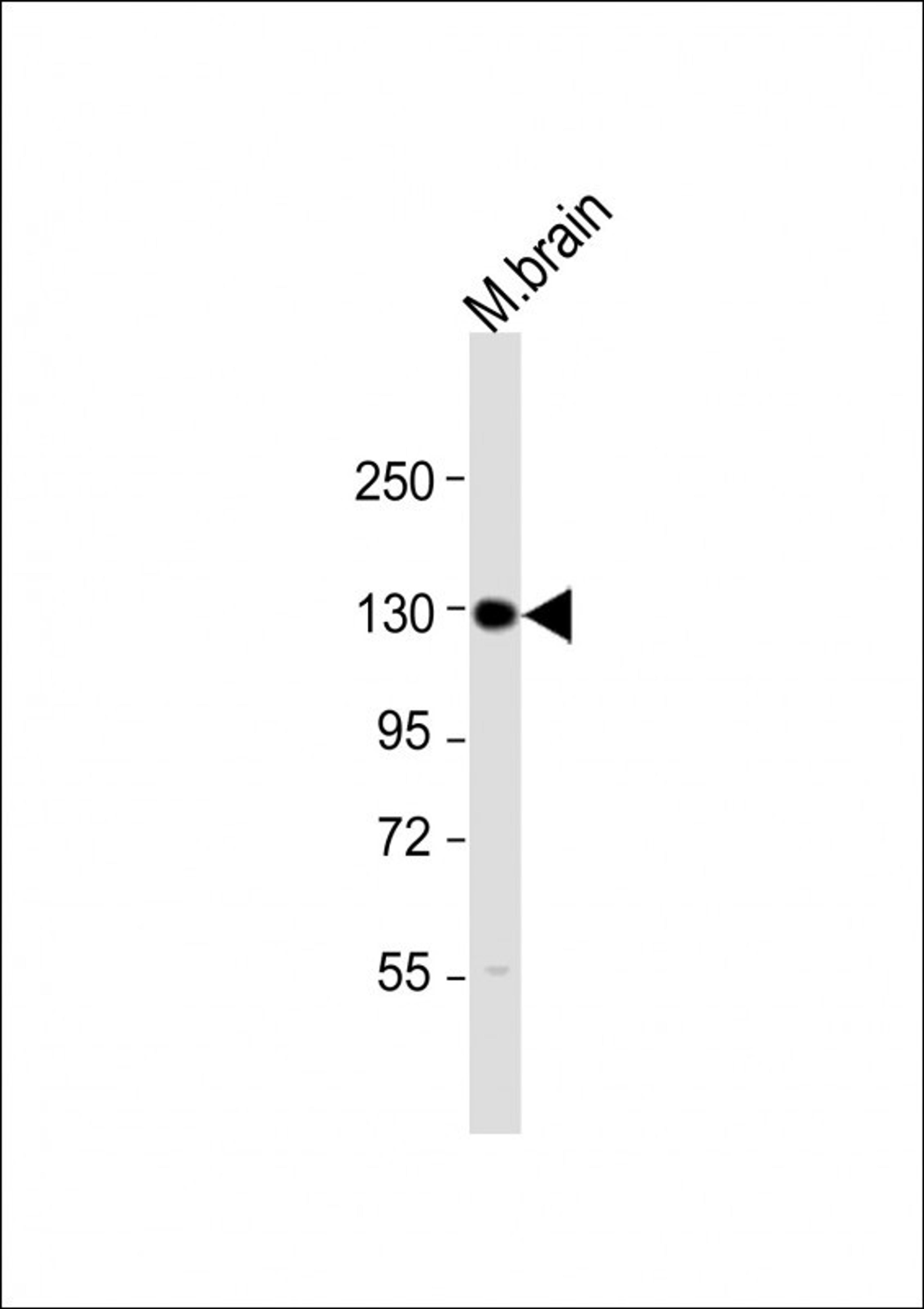 Western Blot at 1:2000 dilution + mouse brain lysate Lysates/proteins at 20 ug per lane.