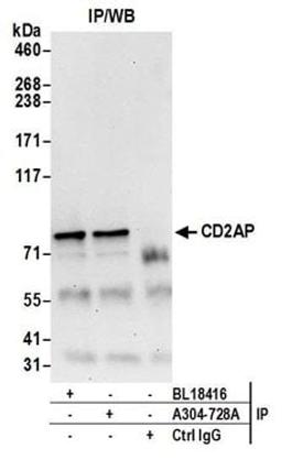 Detection of human CD2AP by western blot of immunoprecipitates.