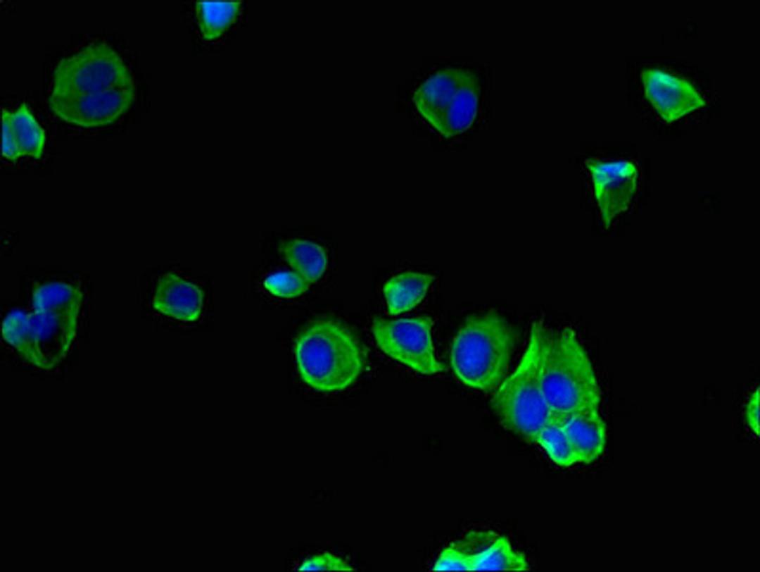 Immunofluorescent analysis of MCF-7 cells using CSB-PA856954LA01HU at dilution of 1:100 and Alexa Fluor 488-congugated AffiniPure Goat Anti-Rabbit IgG(H+L)
