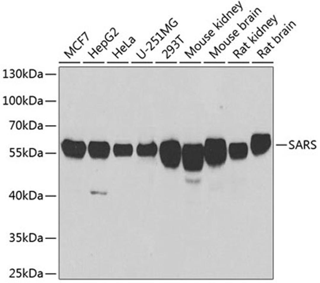 Western blot - SARS antibody (A6733)