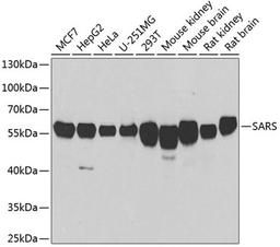 Western blot - SARS antibody (A6733)