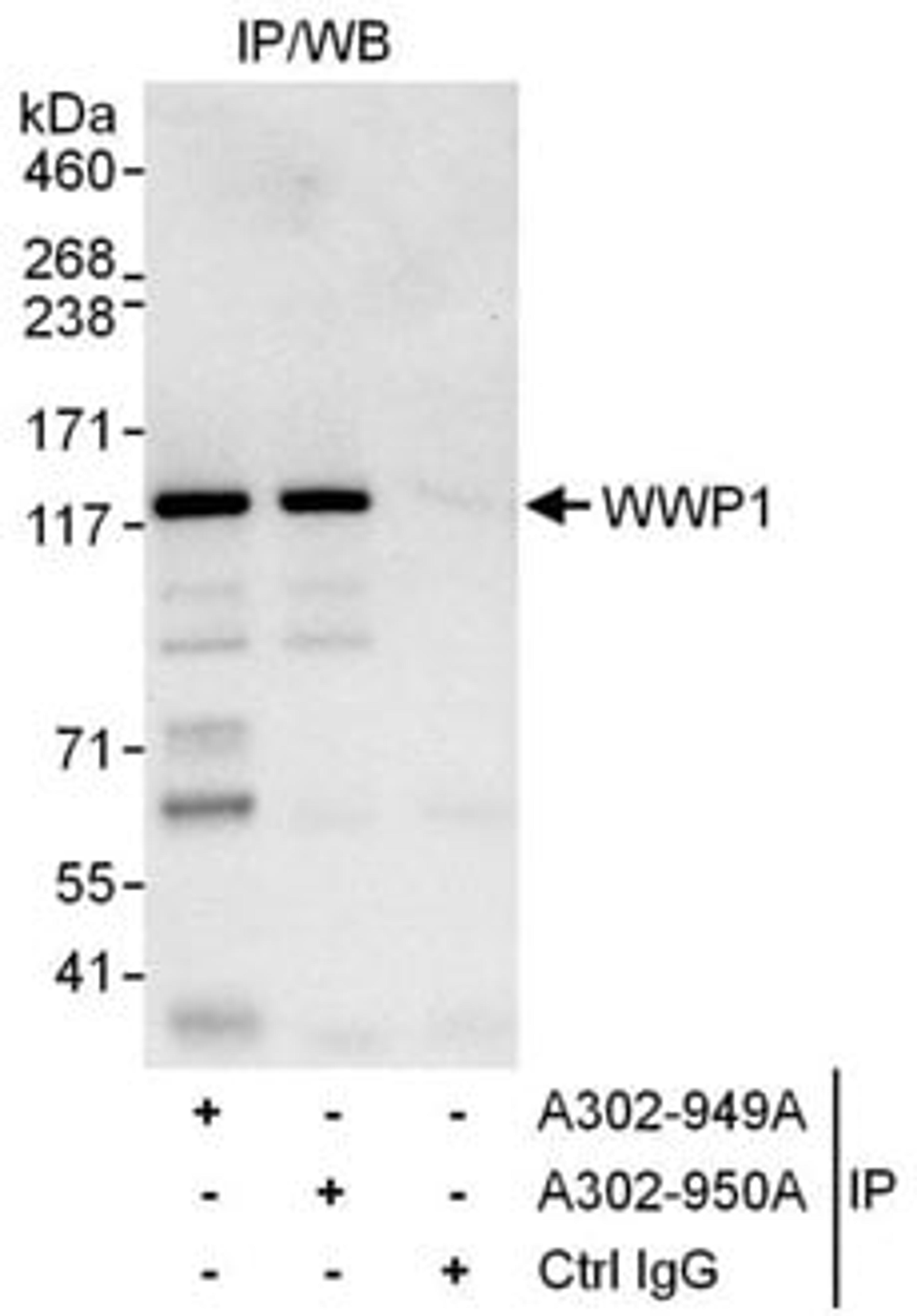 Detection of human WWP1 by western blot of immunoprecipitates.