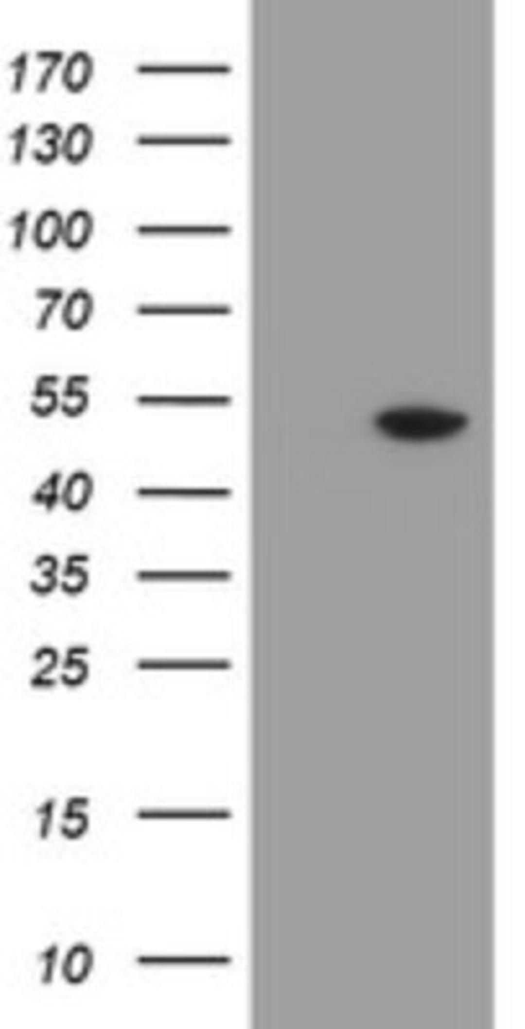 Western Blot: MRPS27 Antibody (6E5) [NBP2-45938] - Analysis of HEK293T cells were transfected with the pCMV6-ENTRY control (Left lane) or pCMV6-ENTRY MRPS27.