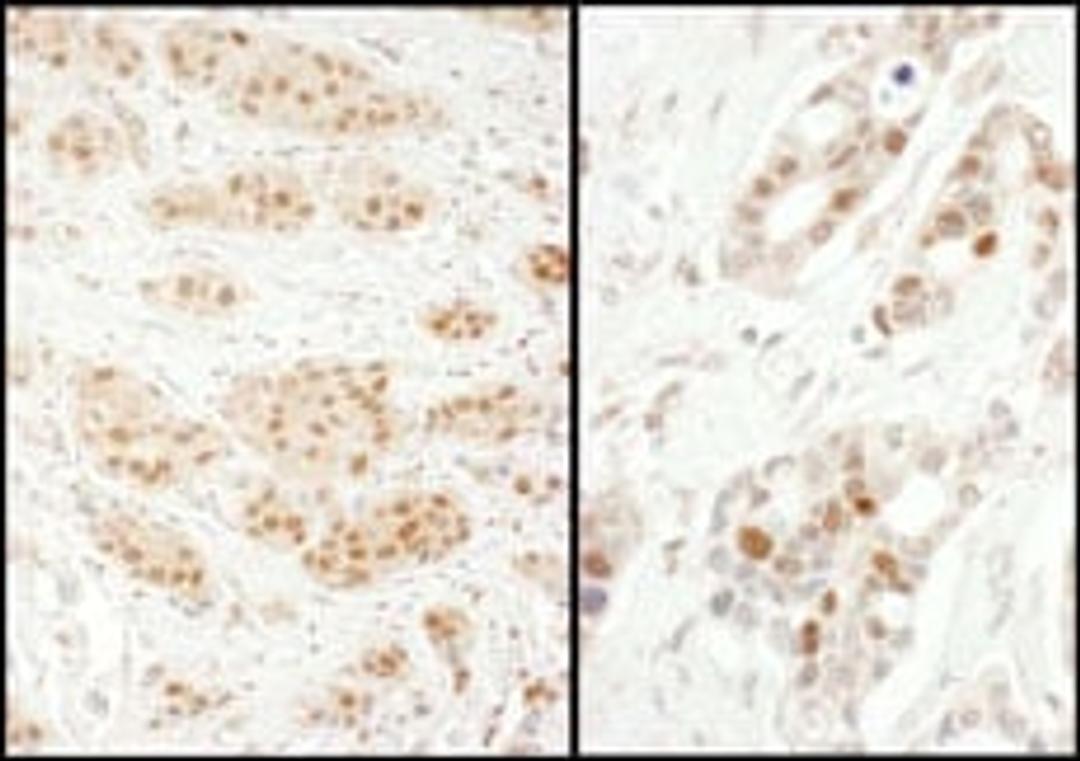 Detection of human Exportin-5 by immunohistochemistry.