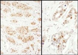 Detection of human Exportin-5 by immunohistochemistry.