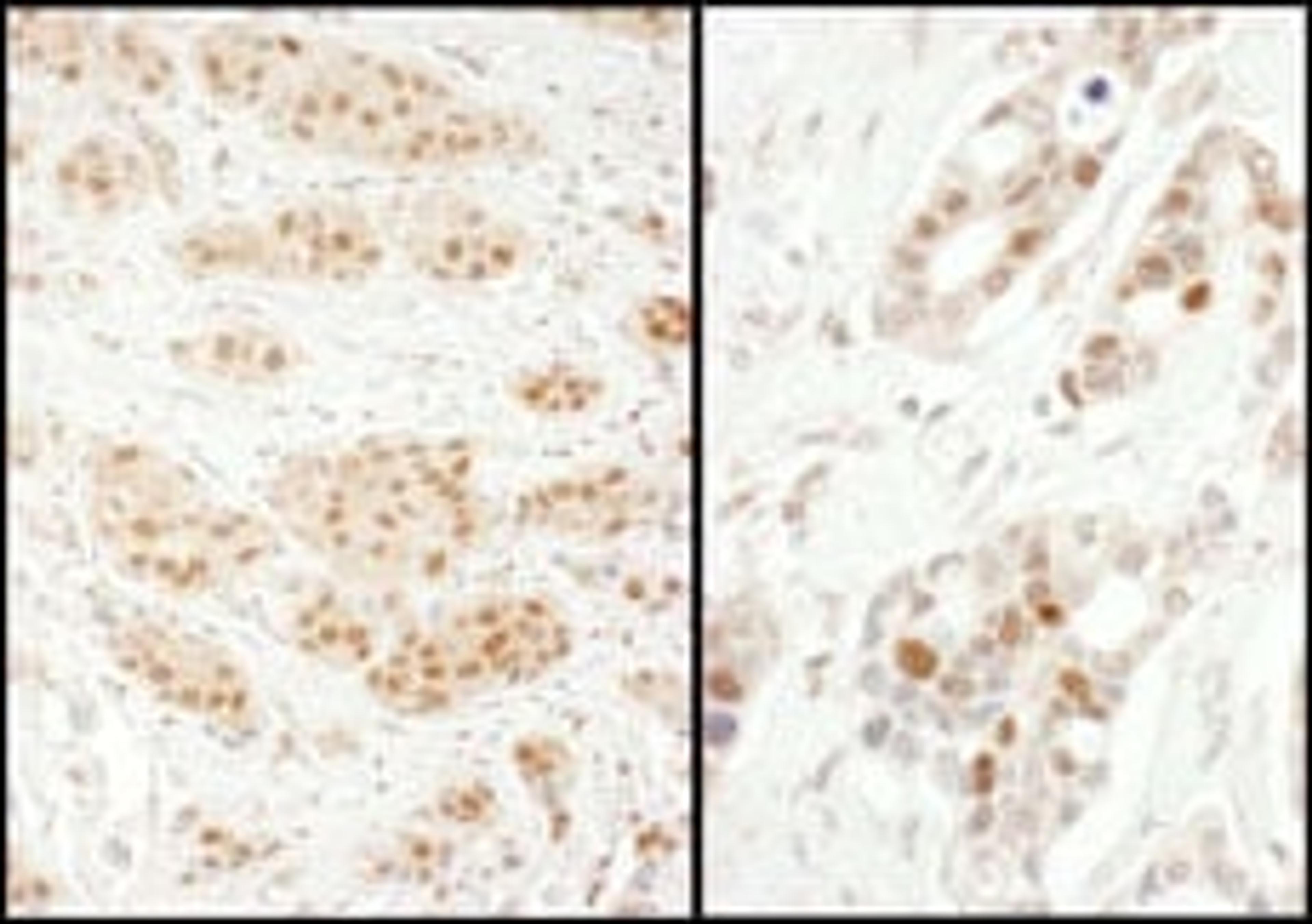 Detection of human Exportin-5 by immunohistochemistry.