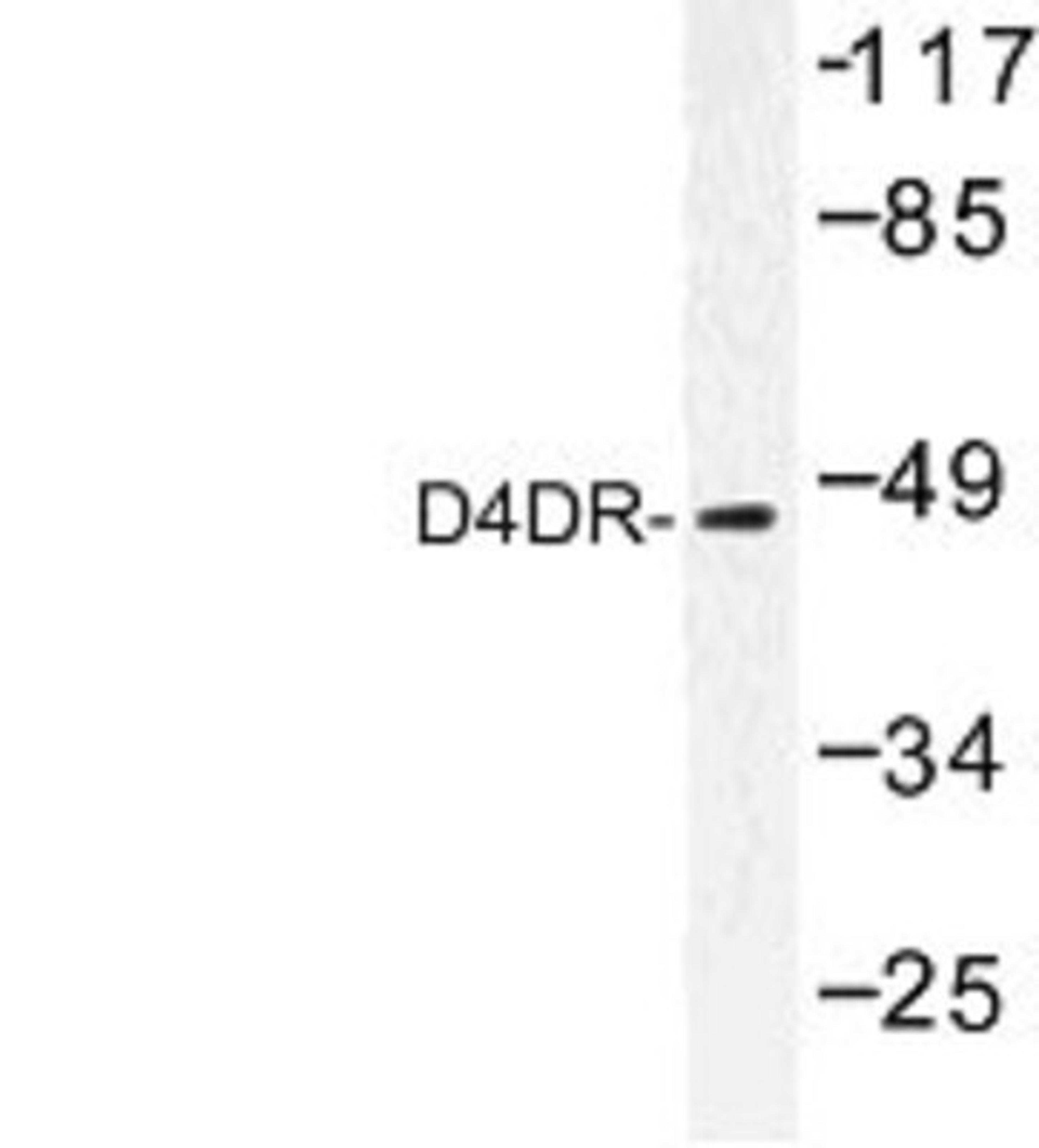 Western Blot: Dopamine Receptor D4 Antibody [NBP1-00779] - Western blot (WB) analysis of D4DR (L396) antibody in extracts from HUVEC cells.