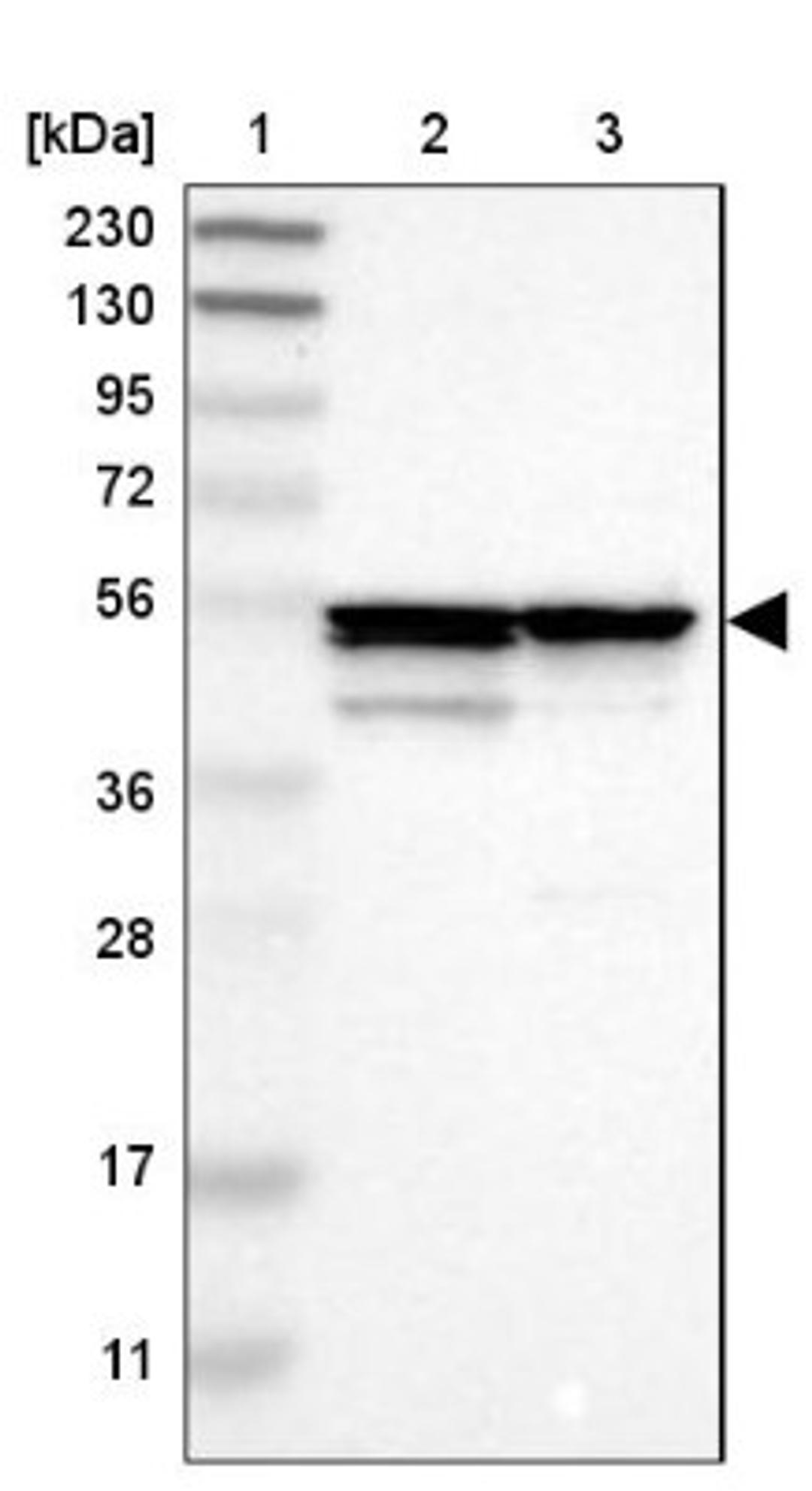 Western Blot: Proteasome 26S S5 Antibody [NBP1-87800] - Lane 1: Marker [kDa] 230, 130, 95, 72, 56, 36, 28, 17, 11<br/>Lane 2: Human cell line RT-4<br/>Lane 3: Human cell line U-251MG sp