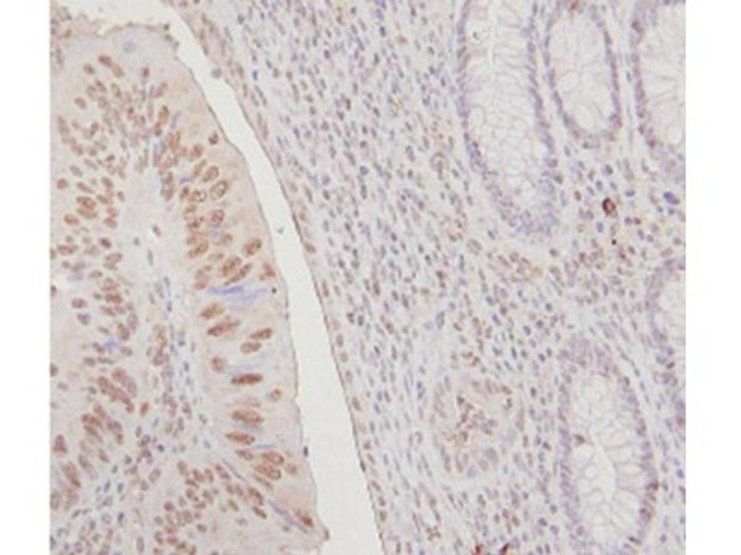 Immunohistochemistry: FANCJ Antibody [NB100-416] - Analysis of FANCJ in human colon and rectum tissues. Image courtesy of an anonymous customer review.